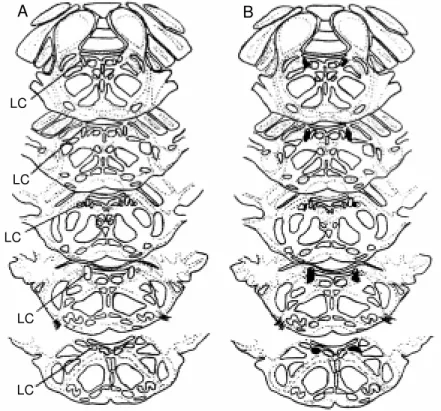 Figure 1 - Representative draw ings show ing the  lo-calization of the locus  coe-ruleus (LC) (A) and lesions (dark areas, B) placed  bi-laterally in the nucleus.