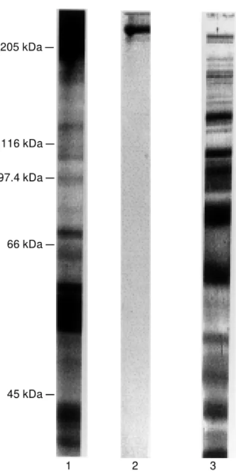 Figure 2 - SDS-PAGE of thyro- thyro-globulin and fragments obtained by limited trypsin hydrolysis