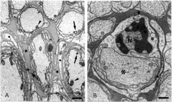 Figure 1 - A, Electron micrograph of the protocerebral tract (PT) t reat ed according t o  Anger-müller and Fahimi (12)