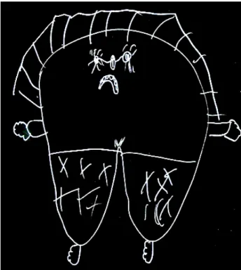 Figure 4. Drawing of an Ill Tooth 
