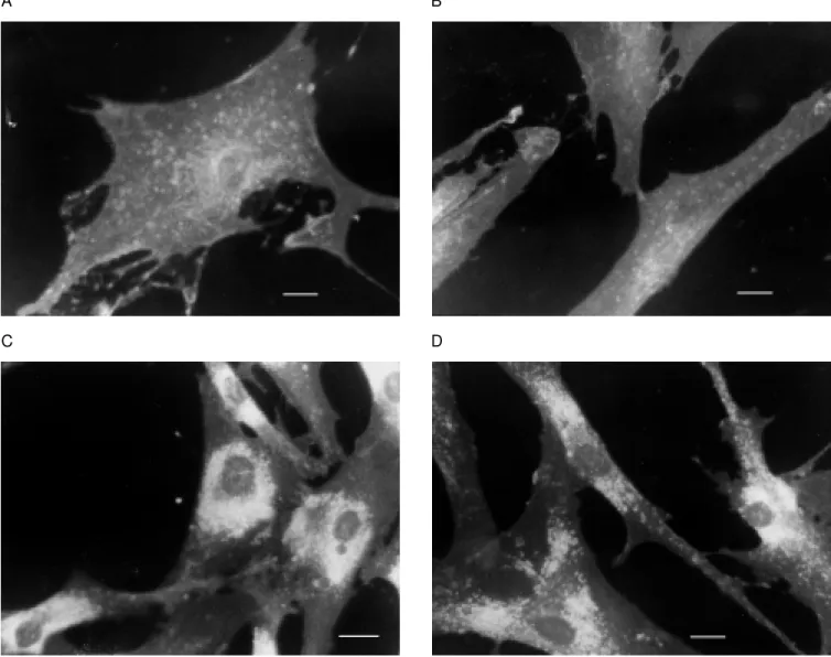 Figure 1 - Normal and Niemann-Pick type C fibroblast cultured w ith LDL for 24 h w ith or w ithout DM SO