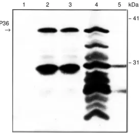 Figure 1 - Detection of P36 ex- ex-pressed in extracts of E. coli.