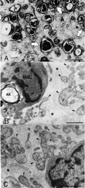 Figure 2 - A, Transverse section of a predegenerated nerve 2 w eeks after sciatic nerve  tran-sect ion