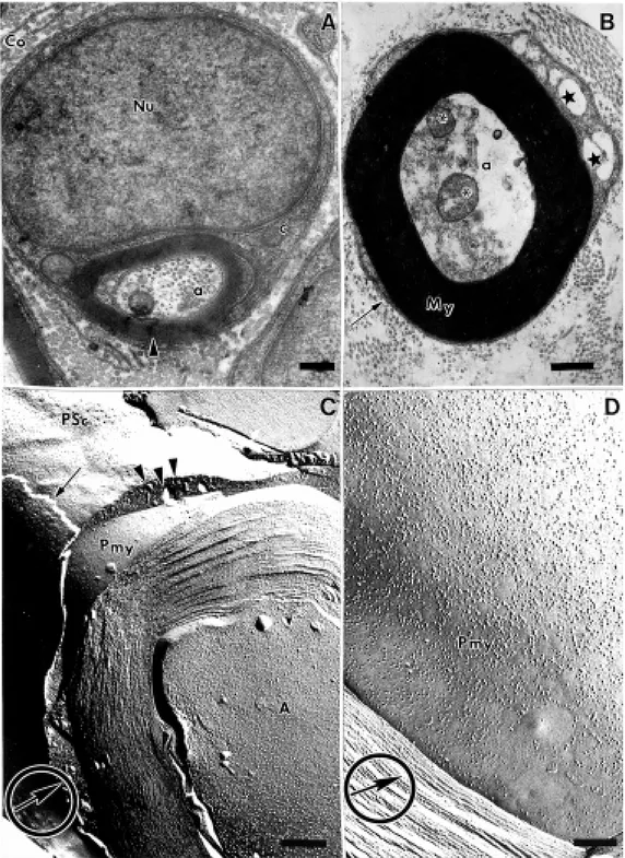 Figure 1 - Transmission electron micrographs of normal and  de-generating myelinated nerve  fi-bers