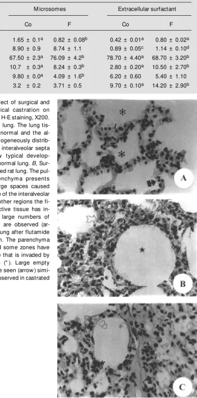 Table 2 - Phospholipid composition of microsomes and extracellular surfactant from male rat lung after administration of flutamide.