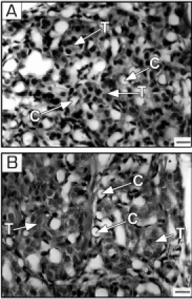 Figure 1 - Photomicrographs of the carotid body from a control rat (A) and chronically hypoxic animal (B)