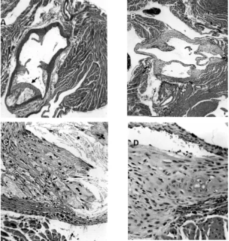 Figure 2. Histology of proximal aorta from apoE -/-  mice fed diets containing 40 IU/kg (control) or 400 IU/kg  a -tocopherol acetate for 6 w eeks