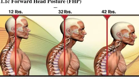 Figure 3 Example of FHP