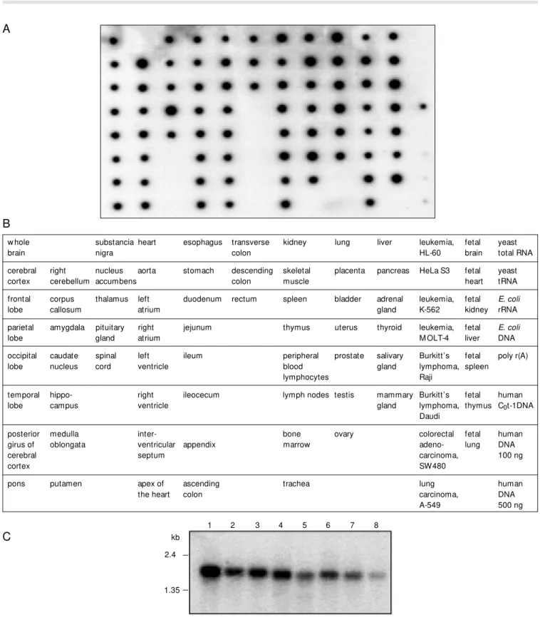 Figure 3. The expression pattern of DDX26 in normal tissues and tumor cell lines. A  32 P-labeled probe w as hybridized under stringent conditions to a Human M aster Blot (Clontech) containing normalized loadings of polyA +  RNA from 75 different human tis