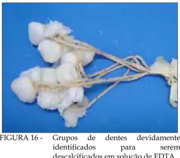 FIGURA 16 -  Grupos  de  dentes  devidamente  identificados para serem  descalcificados em solução de EDTA 