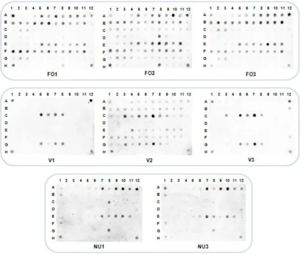 Figure 9. Dot blots of functional markers from the fructose operon (FO1, FO2 and FO3), the virulence-associated genes  hasC (V1), gapC (V2) and oppF (V3) and from the nisin U operon (NU1 and NU3)