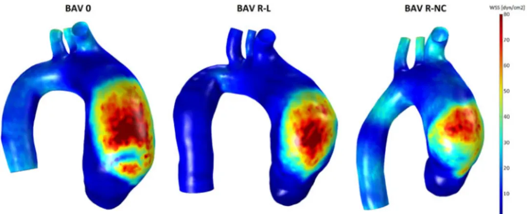 Figure 10. WSS magnitude captured at the two ascending aortic cross-sections, for all BAV models.