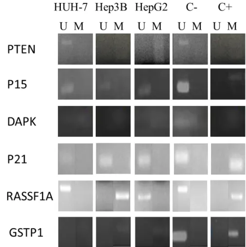 Figure 1 – Gene Methylation pattern in the HCC cell lines, performed by MS-PCR (U- (U-Unmethylated, M-Methylated) 