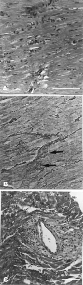 Figure 2 - Photomicrographs of myocardium from a  renovascu-lar hypertensive rat sacrificed  af-ter 4 weeks of left renal araf-tery clipping