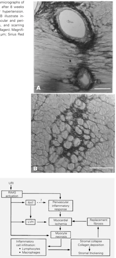 Figure 3 - Photomicrographs of rat myocardium after 8 weeks of renovascular hypertension.