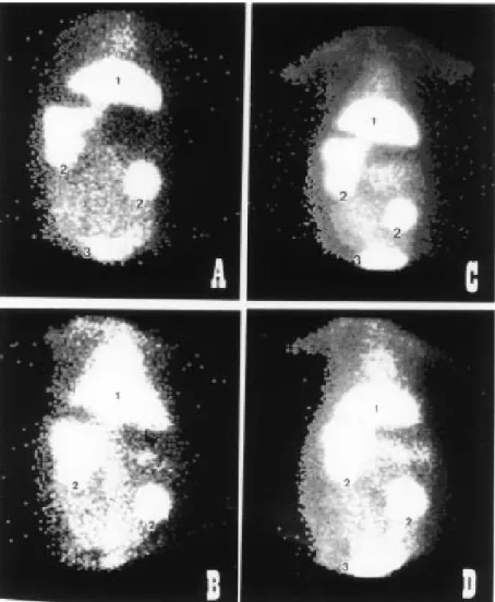 Figure 2 - Biodistribution of  99m Tc-labeled ß-VLDL 6 h after tracer injection. A,  99m Tc-nat-ß- Tc-nat-ß-VLDL in a control rabbit; B,  99m Tc-nat-ß-VLDL in a cholesterol-fed rabbit; C, copper-oxidized 99m Tc-ß-VLDL in a control rabbit; D, copper-oxidize
