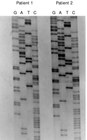 Figure 1 - Wild type p53 exon 5 sequencing from  codon  149-TCC to codon 176-TGC in biopsy specimens from patients 1 and 2