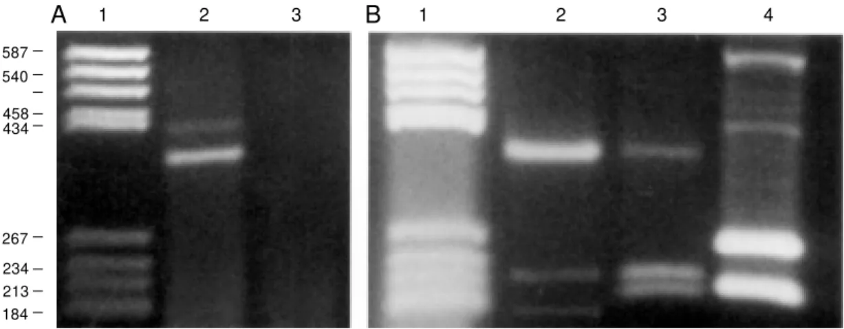 Figure 4 - Determination of the connexin types expressed in rat liver. A, First generation of PCR products indicates that the amplified DNA sequences belong to groups I and II (lane 2), as expected, and its corresponding negative control (lane 3)