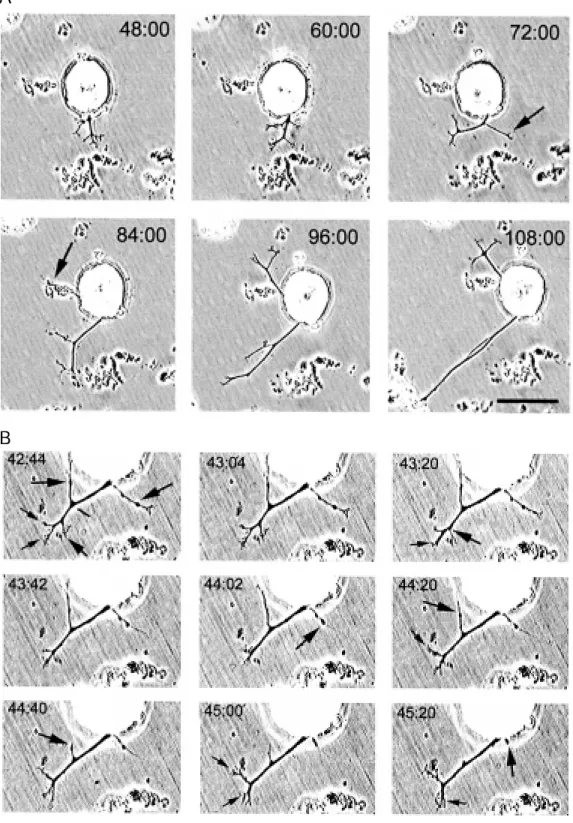 Figure 2 - Development of the outgrow th pattern of one  ante-rior pagoda (AP) neuron plated on leech CNS homogenate