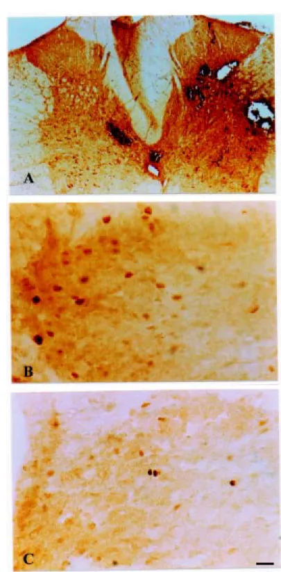 Figure 1 - Expression of Fos protein detected by immunocytochemistry in the thoracic segment of the spinal cord and in midbrain structures