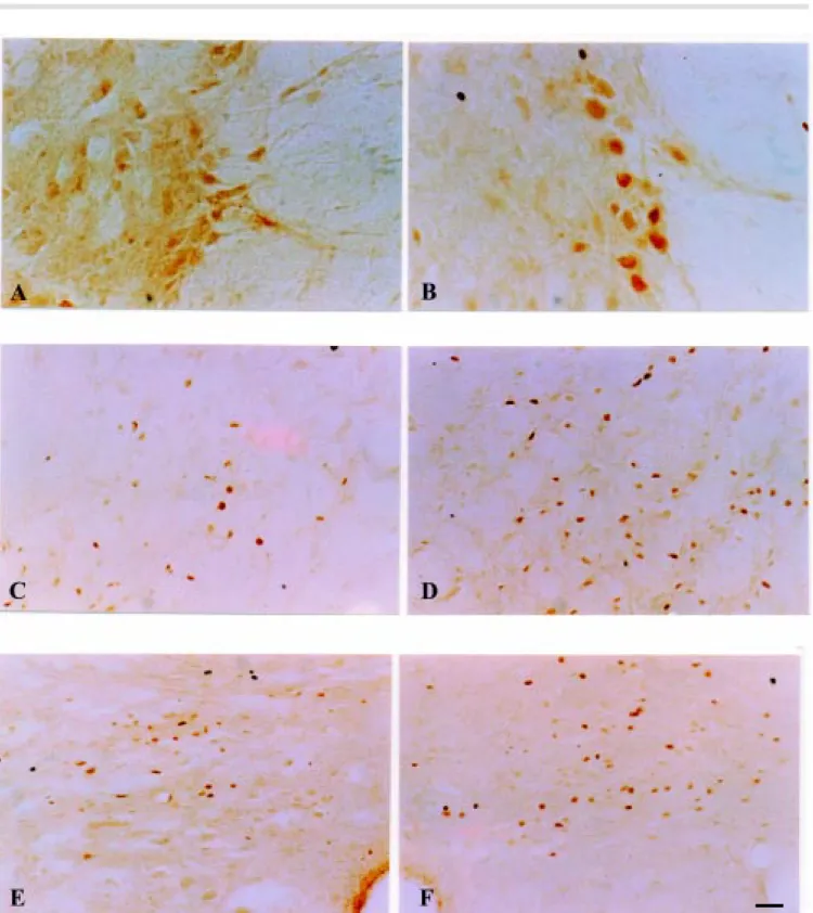 Figure 2 - Expression of Fos protein detected by immunocytochemistry in the thoracic segment of the spinal cord and in midbrain structures