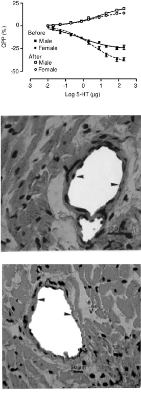 Figure 5. Histological sections perpendicular to the long axis of the heart. The tissues w ere stained w ith hematoxylin/eosin and serial blocks w ere cut at  ap-proximately 3-mm intervals