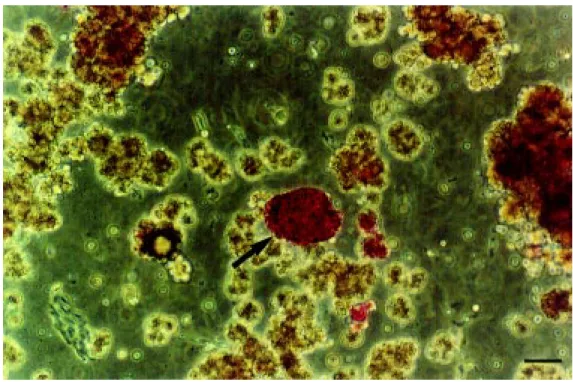 Figure 1. Human pancreatic is- is-lets (arrow ) during the  purifica-t ion procedure, spurifica-t ained w ipurifica-t h dit hizone, w hich specif ically binds to zinc present in ß cell insulin granules