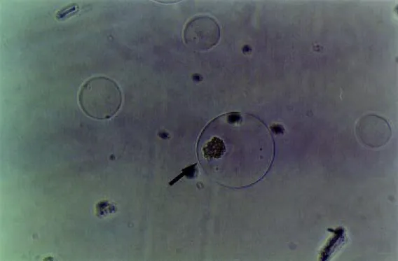 Figure 3. Biodritin capsule of 400 µm in diameter (arrow )  con-taining a human pancreatic islet.