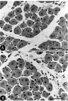 Figure 1. m dx regenerat ed muscle fibers w ith central cell nuclei after 20 (A) and 50 (B) bupivacaine injections