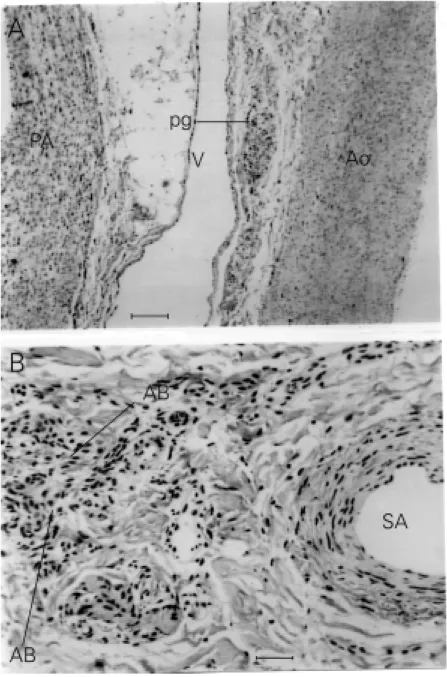 Figure 6. Comparison of small clear presumptive paraganglionic cells and a classical aortic body in the cat