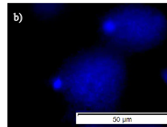 Figura 5. Imagens representativas de cometas com diferentes danos no DNA obtidas através do ensaio do  cometa, realizado em espermatozoides humanos