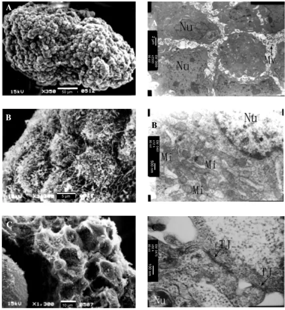 Figure 1. Scanning electron microscopy of 3-D culture of BEL-7402 cells. The 3-D structure lasted 4-5 days.