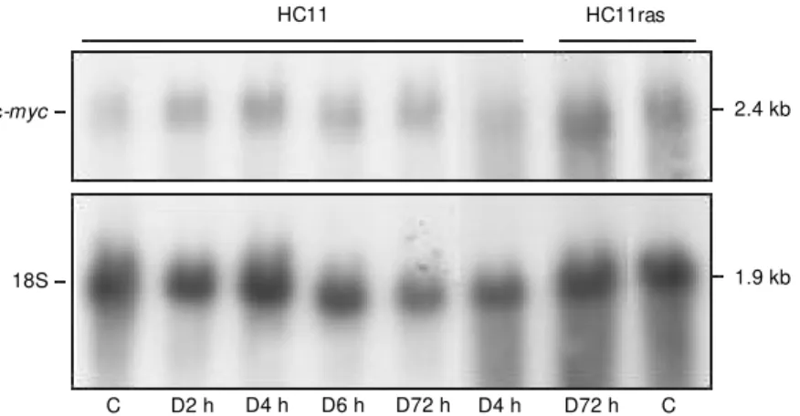 Figure 4. Expression of c-myc mRNA in HC11 and HC11ras cells exposed or not (C, control) to 100 nM  1,25-(OH) 2 D 3  (D) for short (2, 4, 6 h) or long (72 h) periods of time, evaluated in Northern blot assays.