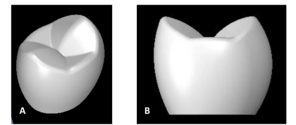 Figura 4  – Modelos 3D do  dente e dos Bráquetes: A –  Bráquete Cerâmico –  Clarity  (Vermelho); B –  Bráquete  Metálico – Gemini (Verde)
