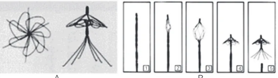 Figure 4. Simon filter. A, Filter in the recovery form. B, Filter release. Taken from Ref