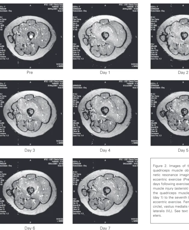 Figure 2. Images of the contralateral quadriceps muscle obtained by  mag-netic resonance imaging (MRI) before eccentric exercise (Pre) and on the 7 days following exercise
