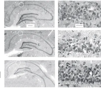 Figure 4 shows the results of repeated iv administration of FK506 (1.0 mg/kg), given 0, 6, 24, 48 and 72 h post-ischemia
