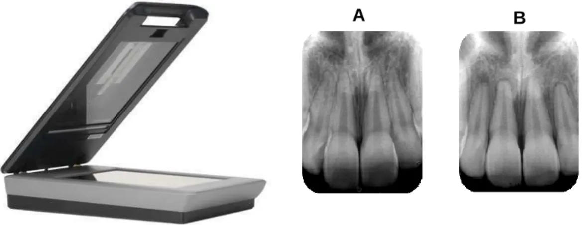 Figura  1  –  Escaner  HP  Scanjet  G4050.  a)  radiografia  periapical  escaneada,  pré- pré-tratamento ortodôntico; b) radiografia periapical escaneada, pós-pré-tratamento ortodôntico