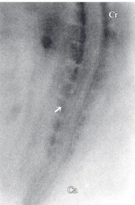 Figure 1.     Photomicrograph of an HH12 chicken embryo. MyoD expression is restricted to  so-mites (arrow)