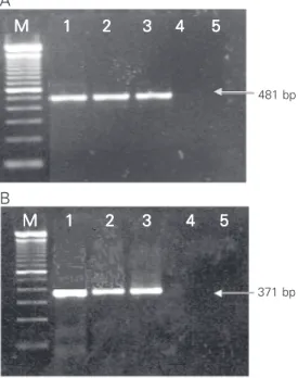 Figure 2. Amplified products from viral samples proliferated in cell culture. Nested RT-PCR-F (A) and nested RT-PCR-G (B).