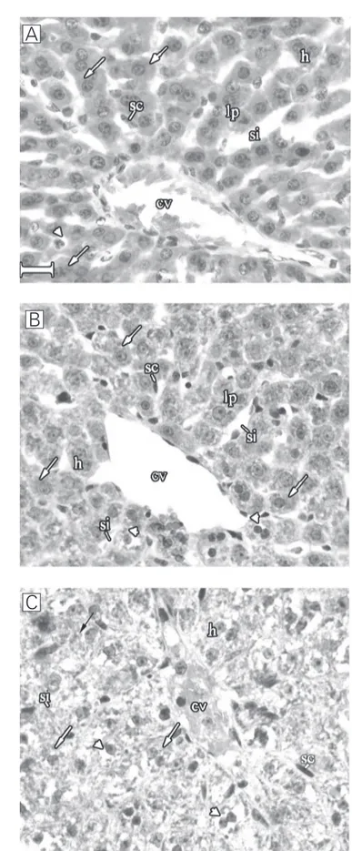 Figure 1. A, Liver tissue from a rat treated with hyper- hyper-baric oxygen before partial hepatectomy (preHBO group)