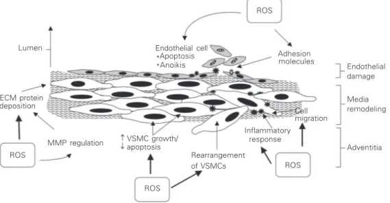 Figure 5. Vascular effects of reactive oxygen species (ROS). Increased bioavailability of ROS influences cellular processes leading to vascular smooth muscle cell (VSMC) growth, inflammation, migration and extracellular matrix (ECM) protein deposition as w