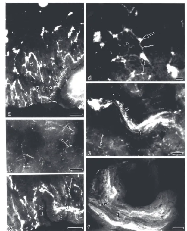 Figure 1. Fluorescent micrographs of the ventral aspect of Megalobulimus oblongus showing catecholamine (CA) and 5-hydroxytryptamine (5-HT) fluorescence in the pedal plexus