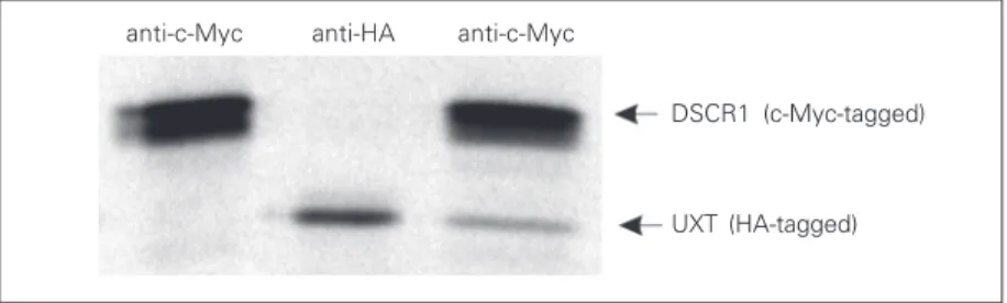 Figure 2. Gel electrophoresis showing that Down’s syndrome candidate region 1 (DSCR1) co-immunoprecipitates with a ubiquitously expressed transcript (UXT) protein