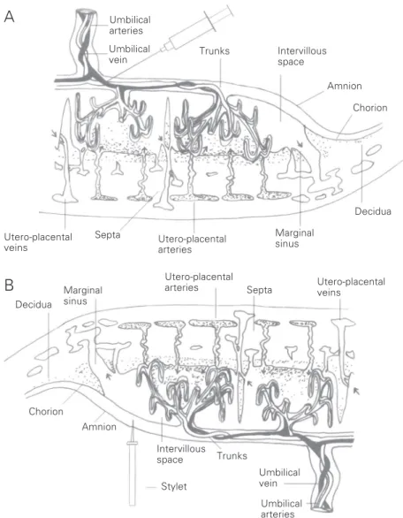 Figure 1. Schematic drawing demonstrating where and how blood was obtained from two different compartments: A, umbilical vein puncture; B, chorionic plate puncture with a stylet to obtain blood from the intervillous space.