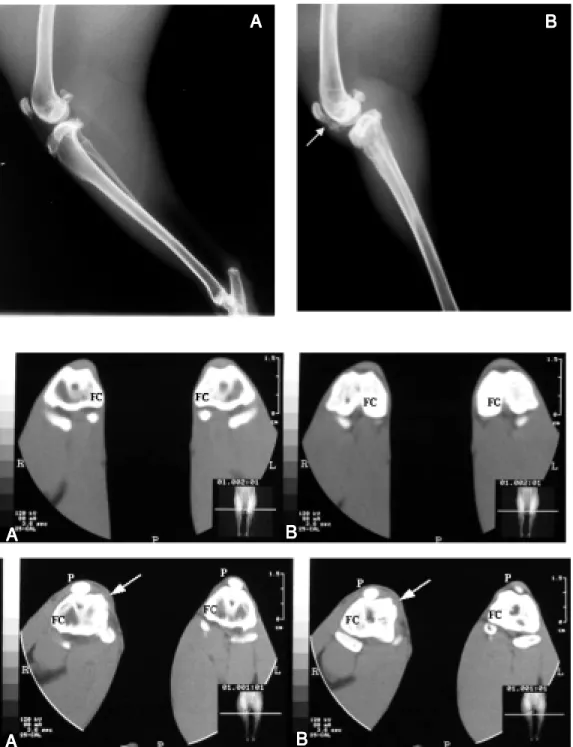 Figure 1. Radiography of the right knee of a rabbit from the control group (A) and of an  im-mobilized knee (B) show ing  pa-tellar ligament mineralization  (ar-row )