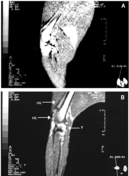 Figure 3. A, Sagittal plane of the right non-immobilized joint of an animal from the control group (animal number 3) in a T1-w eighted spin echo sequence