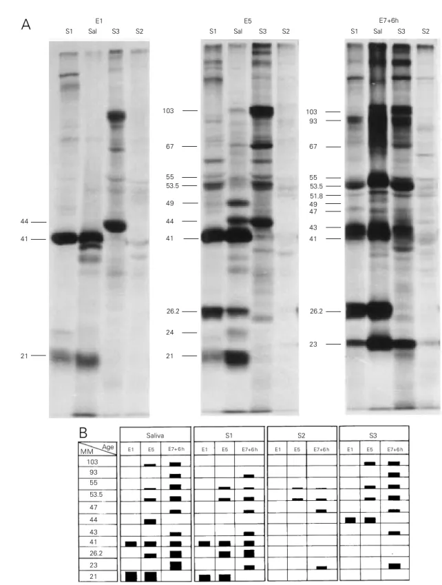 Figure 3 - Fluorographic pattern from the electrophoretic profile of extracts of salivary gland regions (S1, S3 and S2) and saliva (Sal) from larvae of different ages at the end of the fourth instar (E1, E5 and E7+6h)