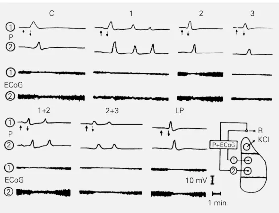 Figure 1 - Examples of electrocorticogram (ECoG) and slow potential change (P) of SD in adult rats
