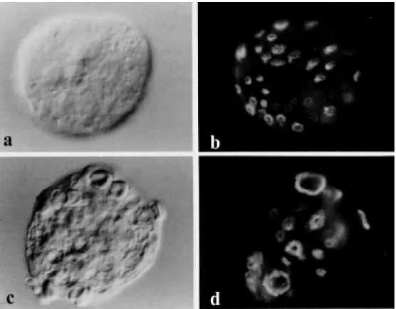 Figure 2 - Differential interfer- interfer-ence contrast (Nomarski) and corresponding fluorescence  mi-crographs of  glut  araldehyde-fixed, Triton X-100-extracted, and rhodamine-phalloidin  tropho-zoites of E